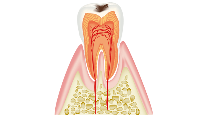 C1